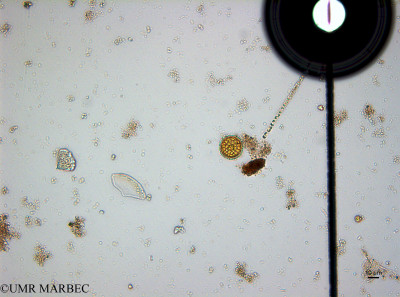 phyto/Guinea golf/Wouri_estuary_Dibamba/YNkouefuthNfongmo_these 2022-2023/Polymyxus coronalis (Di_SURF_2023_centrique2230612_001_ovl-3).tif(copy)_thumb.jpg